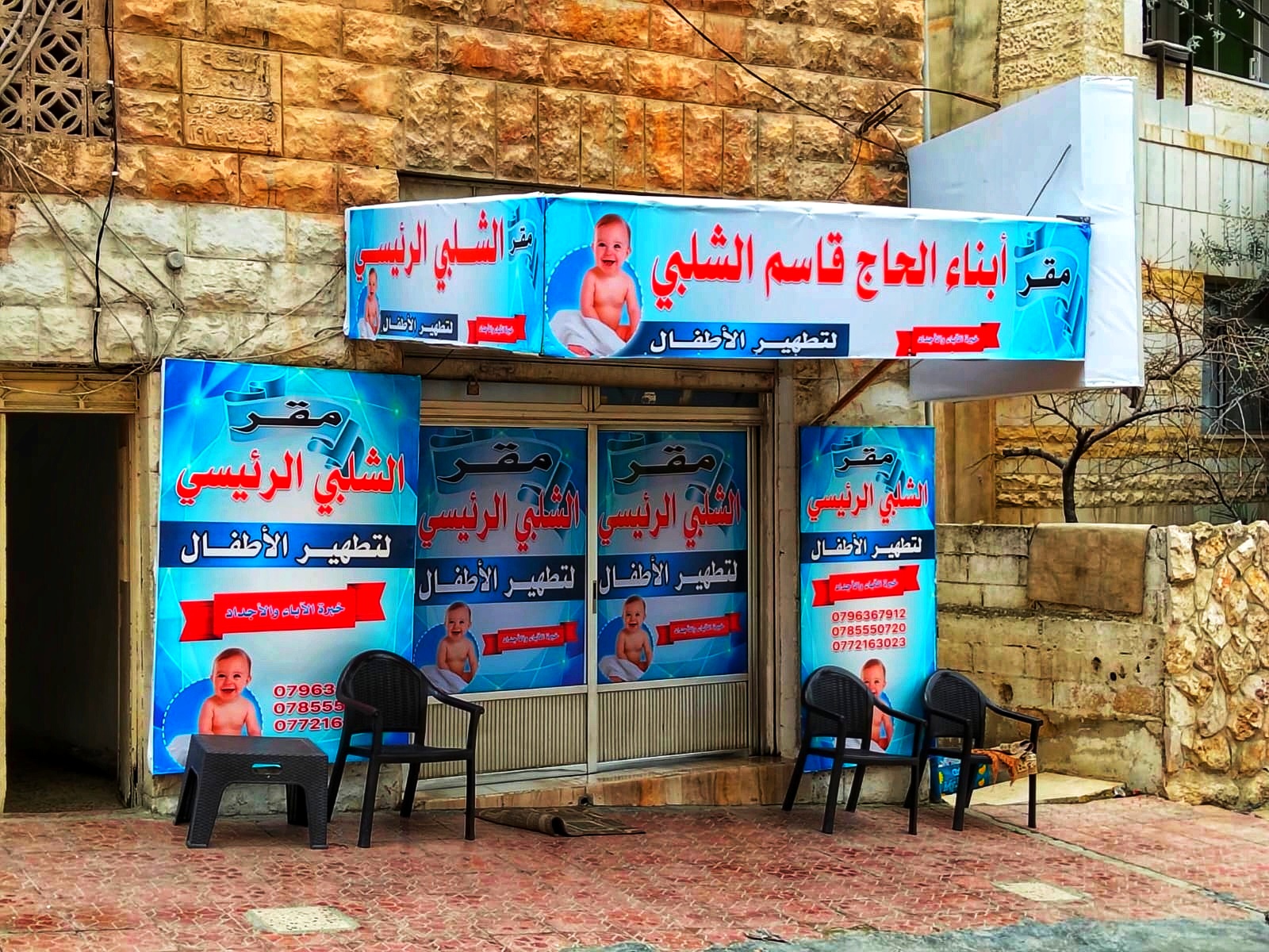 Abu Zaid alshalabi is Male Circumcision in Jordan