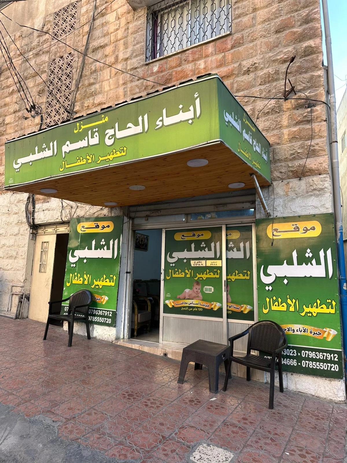 صورة من أبو زيد الشلبي لختان الأطفال في إربد الأردن